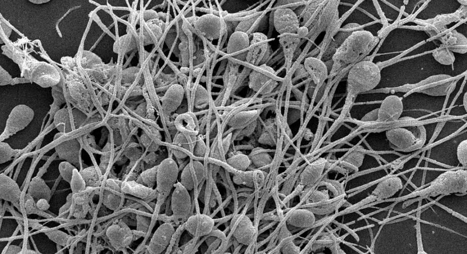 Scanning electron micrograph of sperm cells entangled in fibrous material